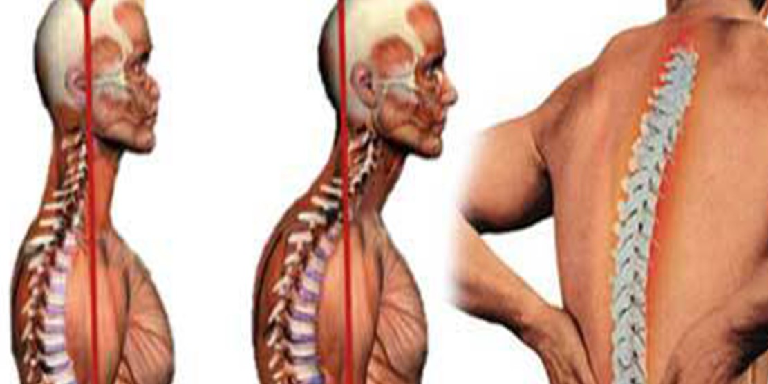 Reumatoidni artritis: 12 znakova na koje trebaš obratiti pažnju