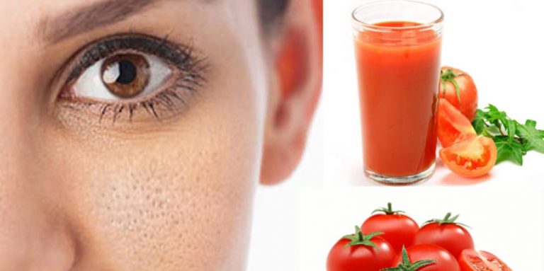 Maske od paradajza za kožu i kosu: Za akne, fleke, pore, za masnu kosu!