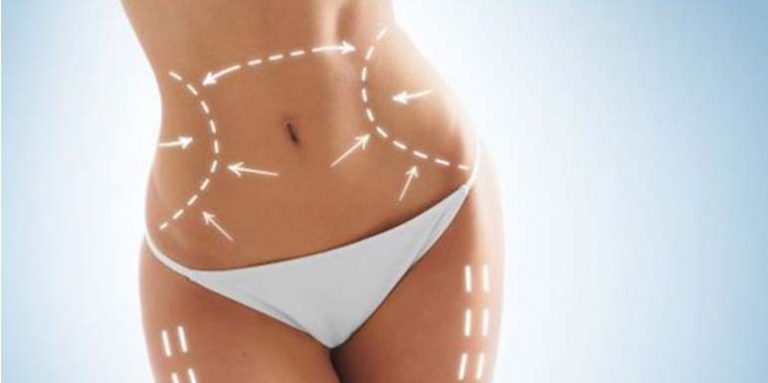 Dr Zoran Lekić: Liposukcija – Brzo i lako oblikovanje tela