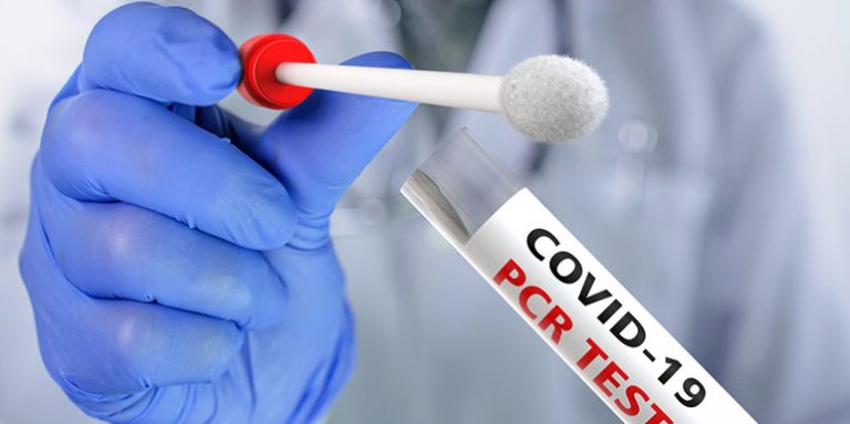 Kućni test na korona virus: Krizni štab upozorava da se ne testirate sami – Zašto su testovi sporni?