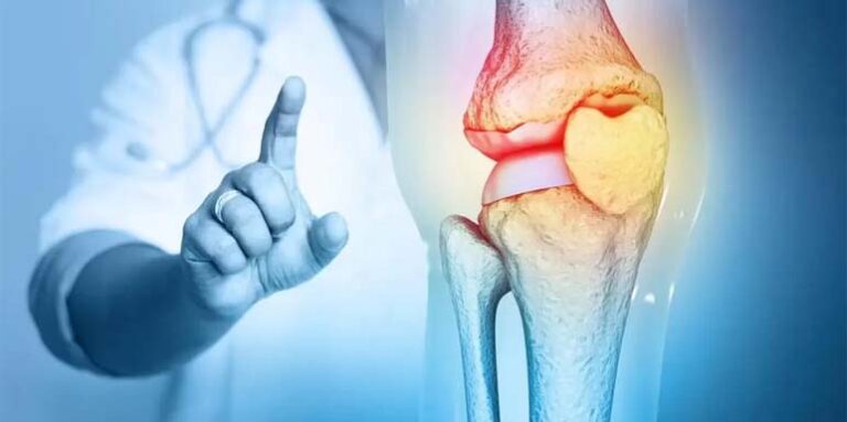 Dr Kecojević: Osteoartritis – Kako nastaje, koji su simptomi i kako se leči?