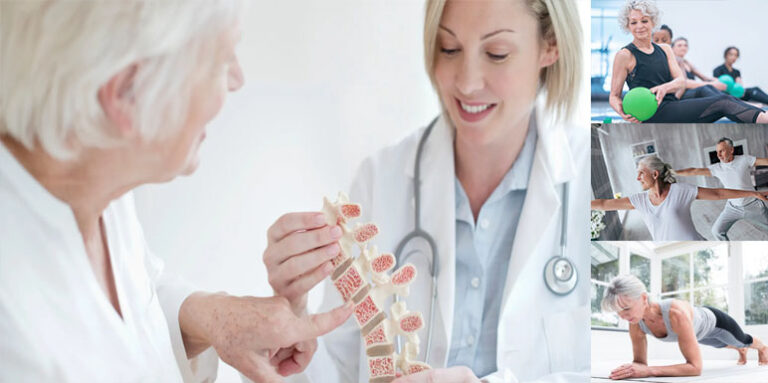 Prevencija osteoporoze: Šta treba da znate